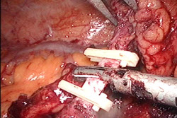 Sezione arteria mesenterica
